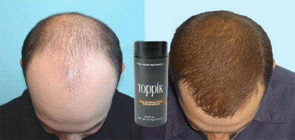 علاج فراغات الشعر Toppik Hair Fibers