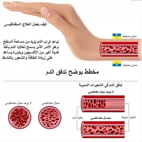 ⁦حظاظة التخسيس⁩ - الصورة ⁦2⁩